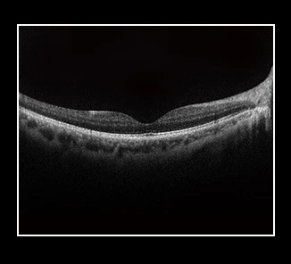 Latest  Optical Coherence Tomography Scanner Eye Examination Ophthalmic Optical Equipments fundus camera