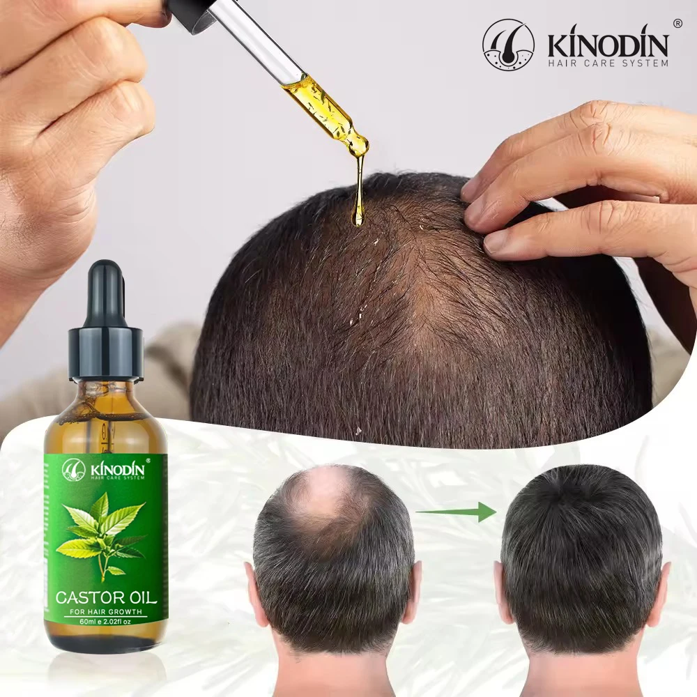 100% pure hair growth Castor oil  Dry Damaged Hair rosemary growth serum for Stronger Thicker and Longer Hair