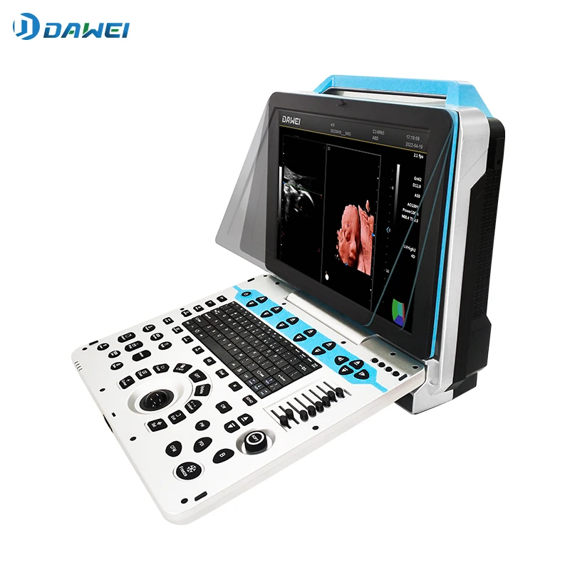 obstetrics and gynecology 3D ultrasound color doppler for pregnancy