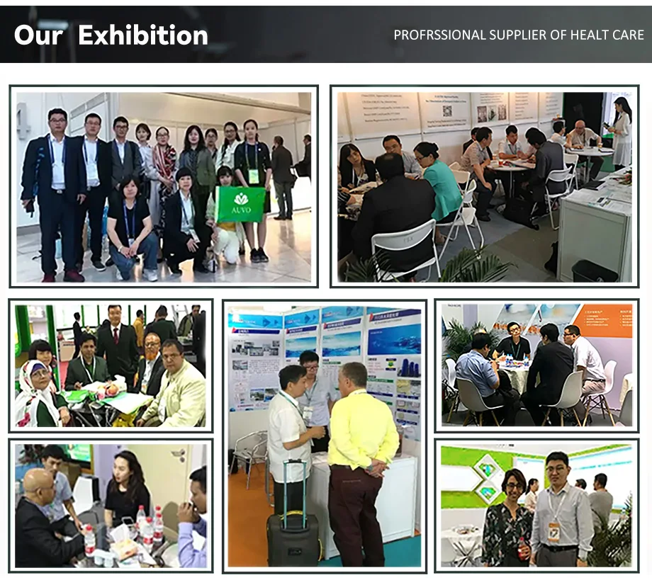 AUVO Top quality Bacillus Amyloliquefaciens Powder agriculture grade Bacillus Amyloliquefaciens