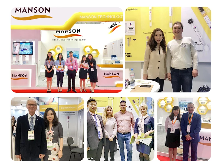 MANSON Plasma Joint Injections Vampire Procedure PRP Injections For Arthritis Atrophic vaginitis Female stress