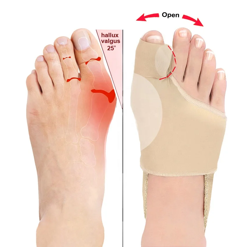 MediFootCare Wholesale Custom Fabric Gel Hallux Valgus Orthopedic Bunion Corrector Belt Protector Sleeve with Toe Separator