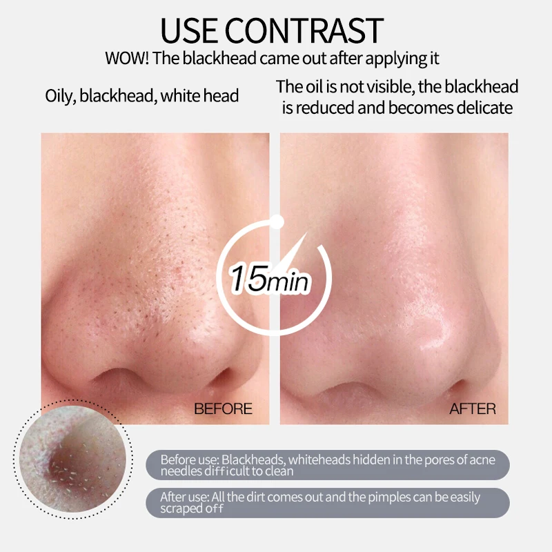 Private Label Face Volcanic Clay Mask Organic Acne Removal Moisturizing Skin Care Mud Mask