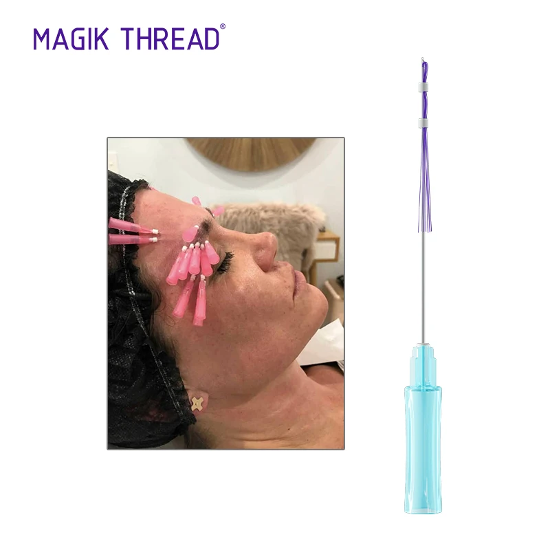 Magik Thread beauty product V line face lift absorbable thread mono mesh multi pdo thread