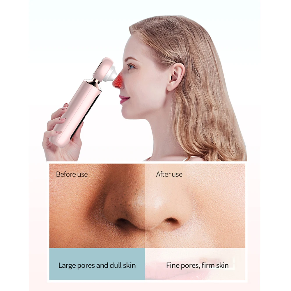 
New Rechargeable Blackhead Tools Visualize Blackhead Deep Cleansing Nose Black Head Remover 
