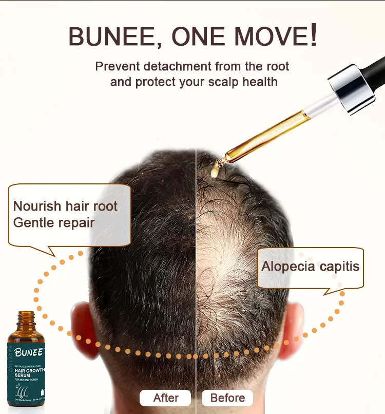 Bunee Thinning Hair Loss Treatment Liquid Solution Serum 60ml regrowth Oil