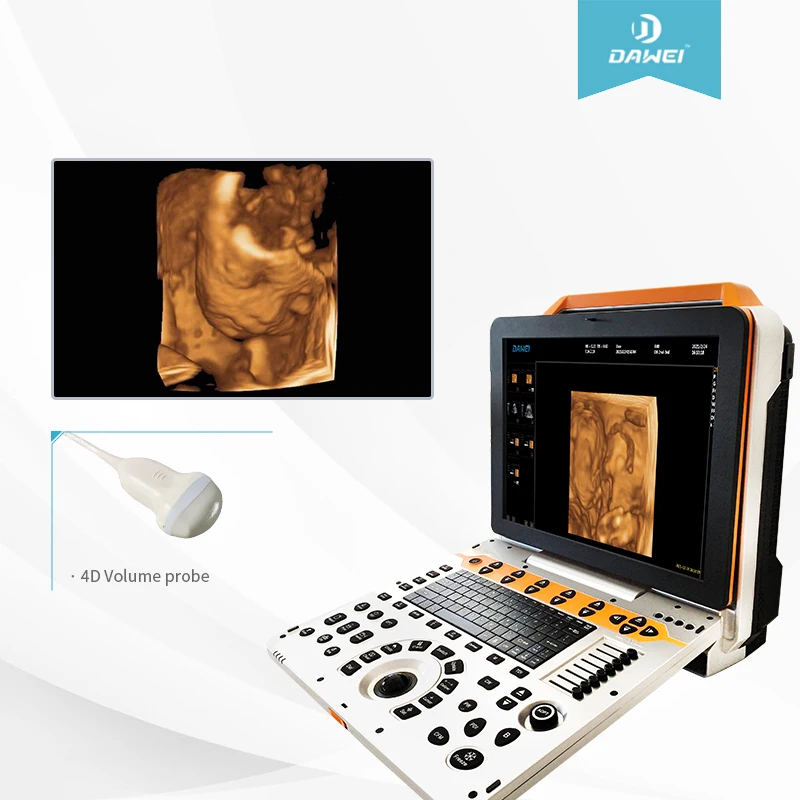 DAWEI P60 4D Portable Color Doppler Human Ultrasound Gynecology Cardiovascular Echo Machine Sale scanner with CE&ISO certificate