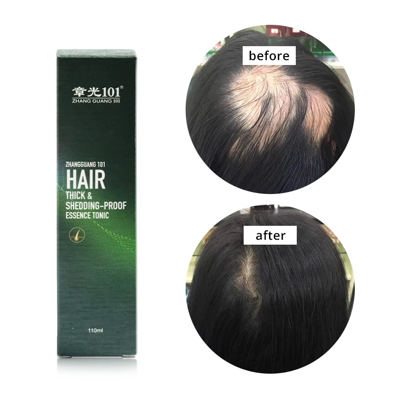 High Quality Ginseng Extract Herbal Hair Tonic Hair Repair Growth Serum