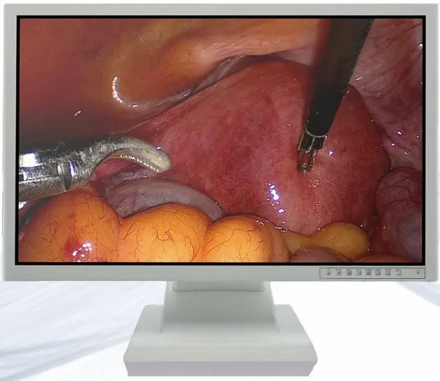 HD video gastroscope/colonoscope endoscope system with dyeing function medical equipment price