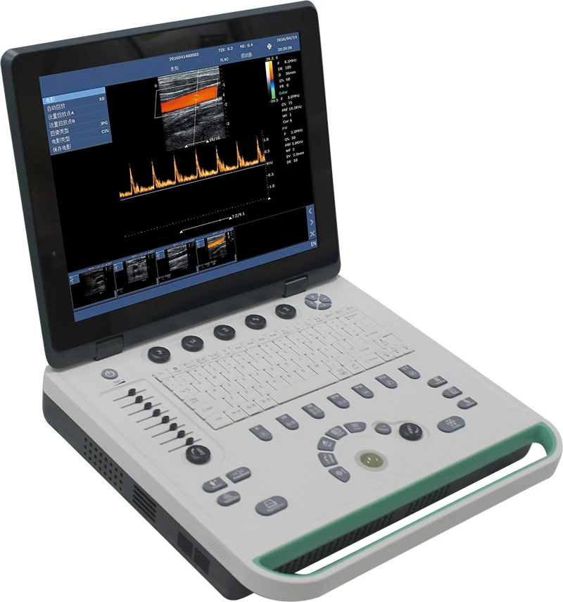 C5mini Portable Laptop Color Doppler Ultrasound Machine System