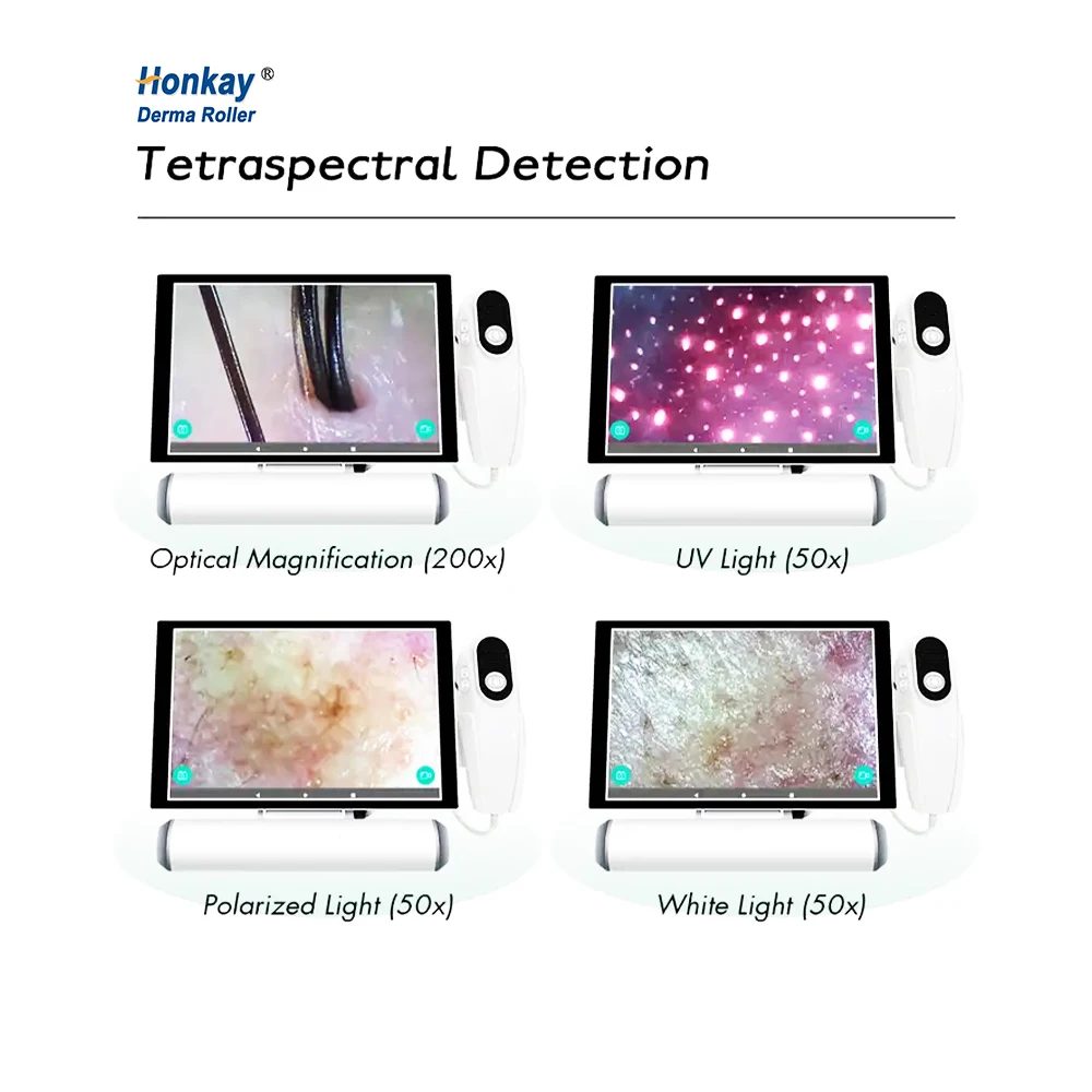 Honkay USB Scalp Analyzer Scanner Machine Home Use Hair Follicle and Scalp Analyzer Equipment USB Plug US/UK Type