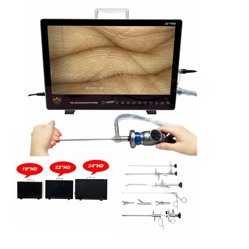 SY-PS050 Portable HD Endoscopy Camera Medical Imaging Equipment  ENT Laparoscopy Hysteroscopy Urology Endoscope Camera