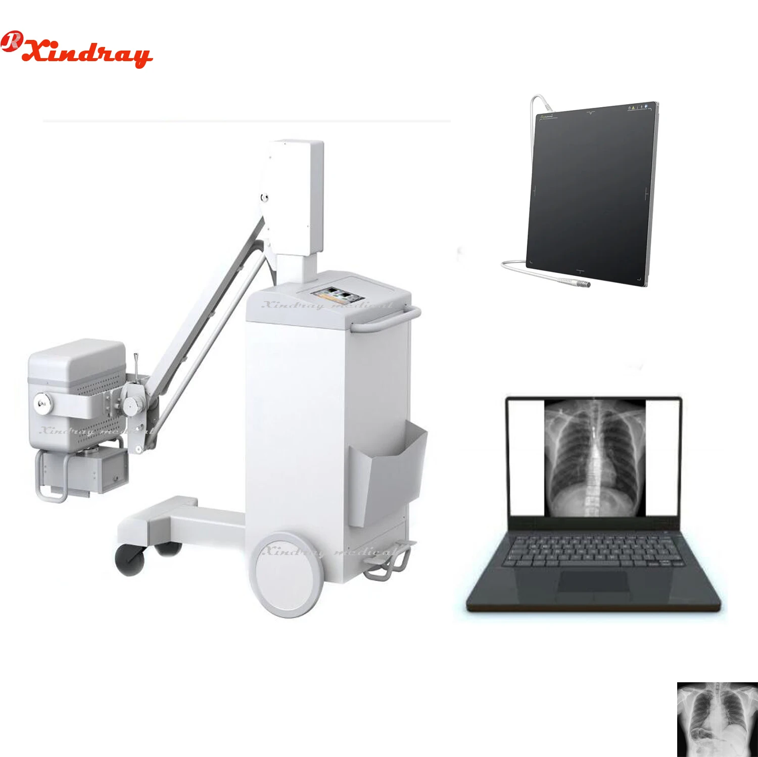 High Frequency 150MA X ray Mobile Machine with panel Laptop Software with  X-ray generator for Imaging