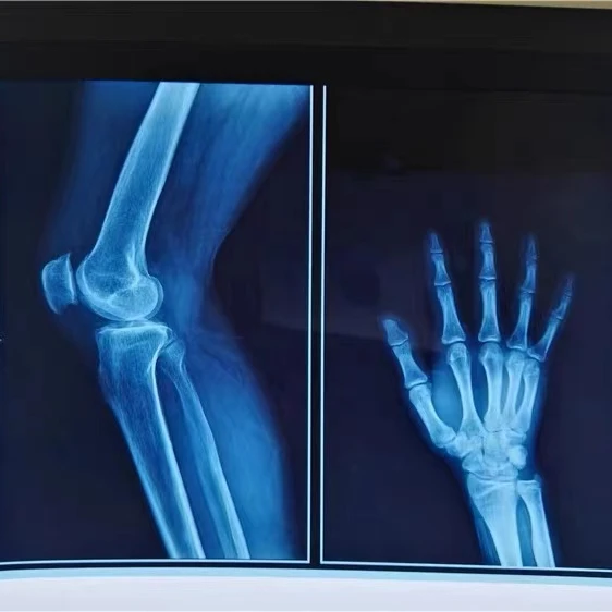 Blue Inkjet Medical Dry Film CT DR MRI X Ray Blue Transparent Film