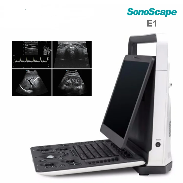 Medical Ultrasound Instruments Sonoscape E1 Black white Ultrasound machine Scanner Analyzer with Pw