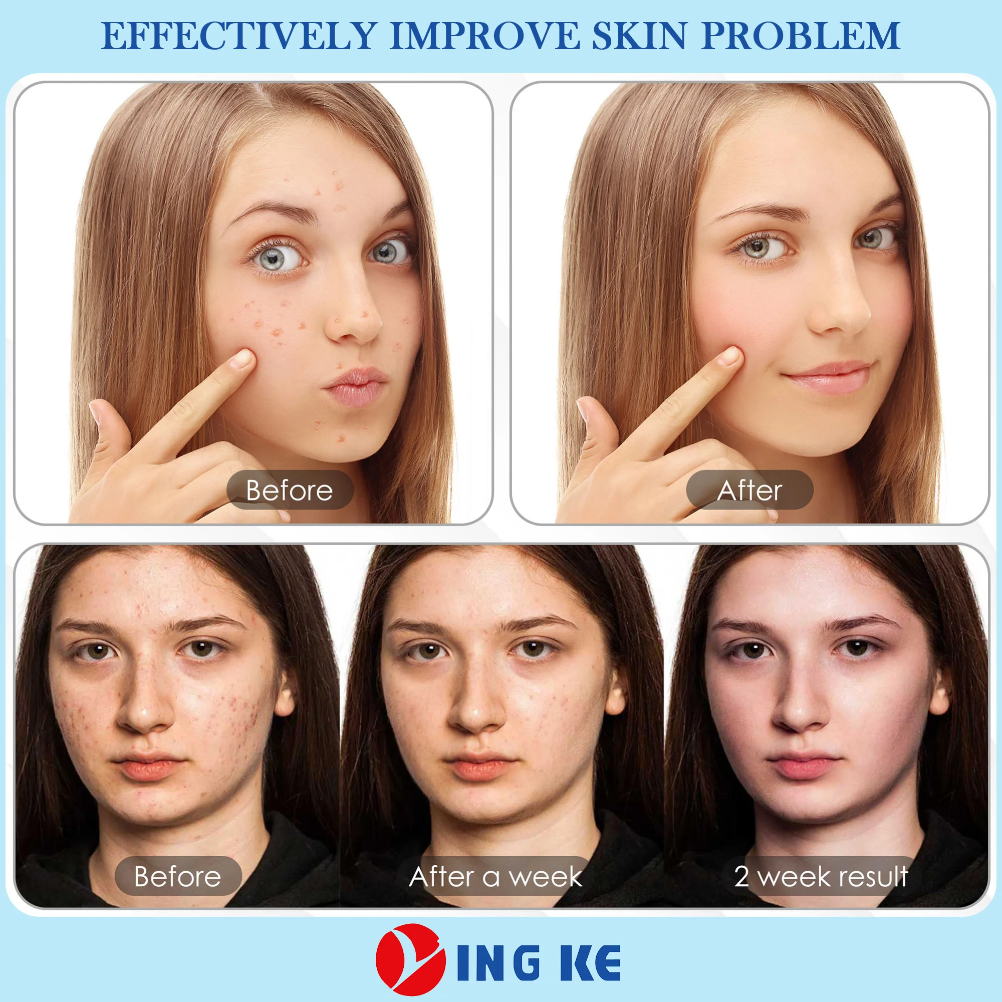 OEM ODM Beauty Machine 7 Colors LED Face Light Therapy Red Light Therapy for Face Photon LED Light Therapy Machine