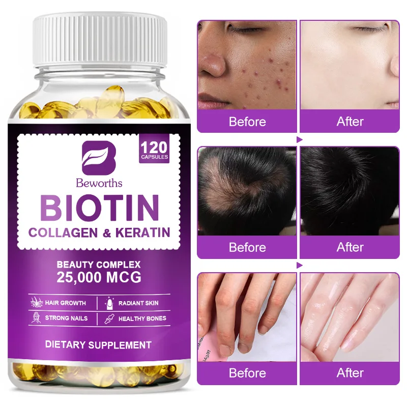 Private Label 60pcs Biotin Collagen Softgel Capsules Vitamins Biotin Supplement for Hair