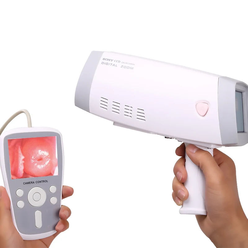 Most popular products Handheld Portable Hospital inspection Gynecological equipment Video Colposcope