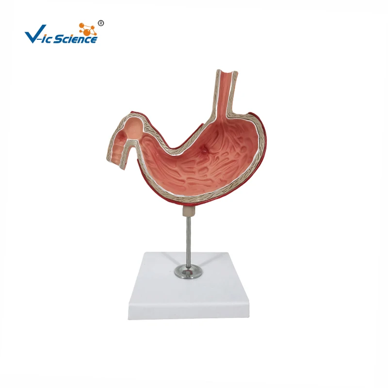 anatomical models for medical teaching stomach With Ulcers Anatomy Model human digestive system model