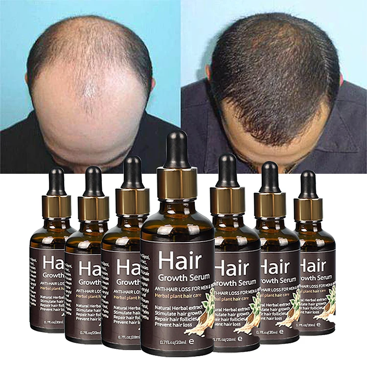 Private Label 7 Days Black People Regrowth Ginger Hair Growth Oil Serum Scalp Treatment High Quality Hair Follicle Repair Oil