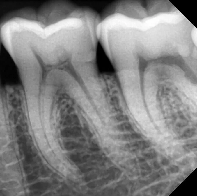 Digital Dental Panoramic portable x ray machine digital x ray for x ray machine price