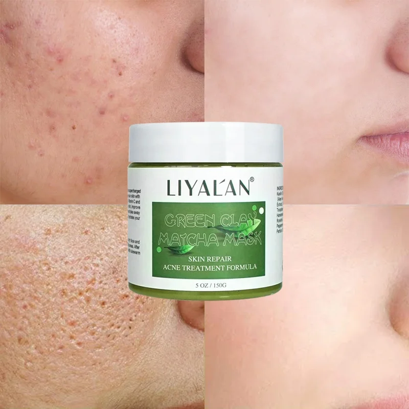 Private Label Face Detoxifying Oil Control Acne Removal Whitening Bentonite Green Tea Matcha Mud Facial Clay Mask