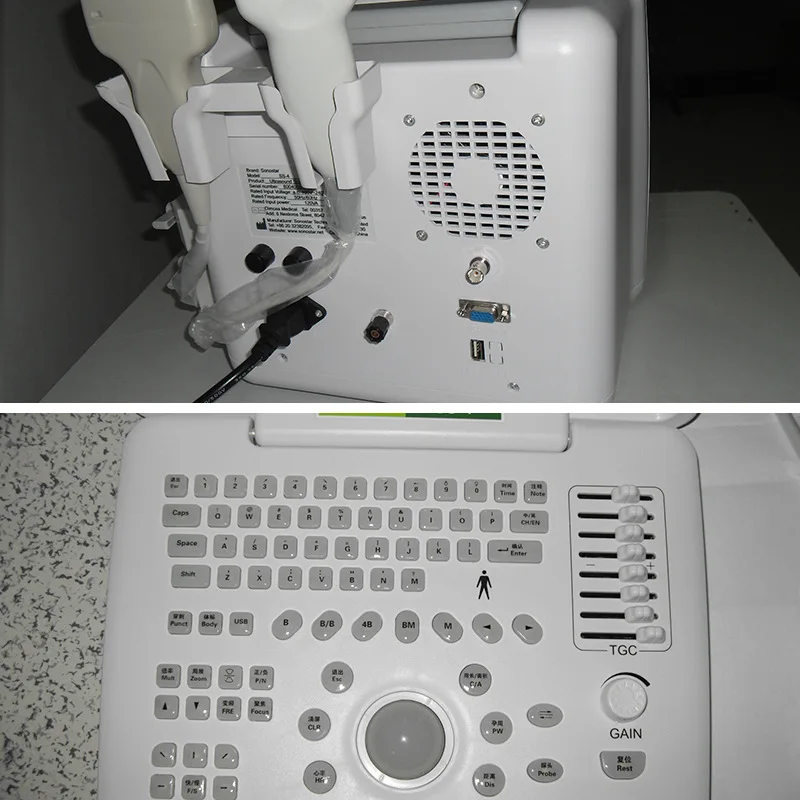 Portable B-mode Ultrasound Machine Portable B-mode Ultrasound Machine B scan device