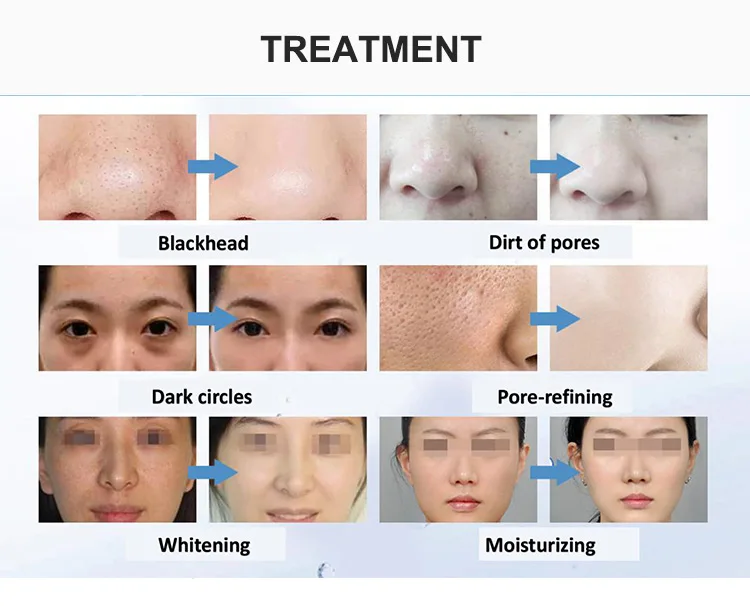 Good Quality Neck Face Beauty Device Anti-Wrinkle Anti-Aging Facial-Machine-7-In-1