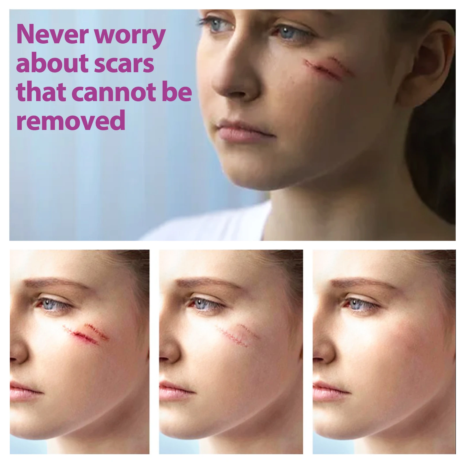 Amazon hot selling acne scar treatment ointment scar removal cream for surgical acne  scald scar