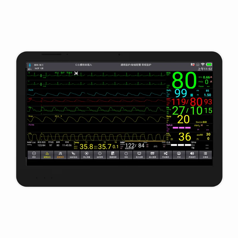 CONTEC CMS8500 Multiparameter portable vital sign monitor cardioc patient monitor