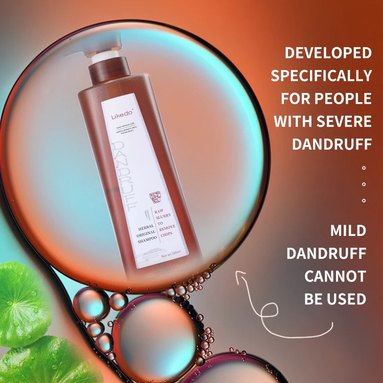 Customization Private Label for Anti-dandruff Problem High Treatment Scalp Problem Effective Anti-dandruff Hair Shampoo