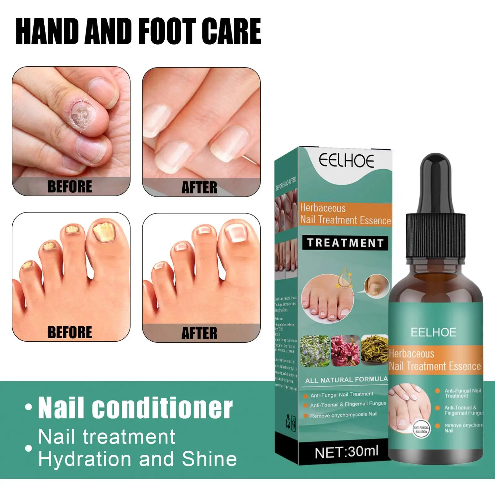 OEM ODM Nail Fungal Treatment Feet Care Essence Anti Infection Paronychia Onychomycosis Nail Foot Toe Nail Fungus Removal Liquid