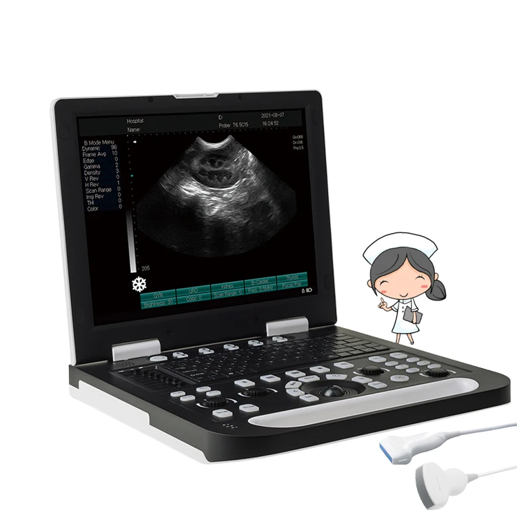 Wholesale Price Laptop Ob Gyn Vessel Portable Ultrasound Machine Scanner B/W Laptop Ultrasound