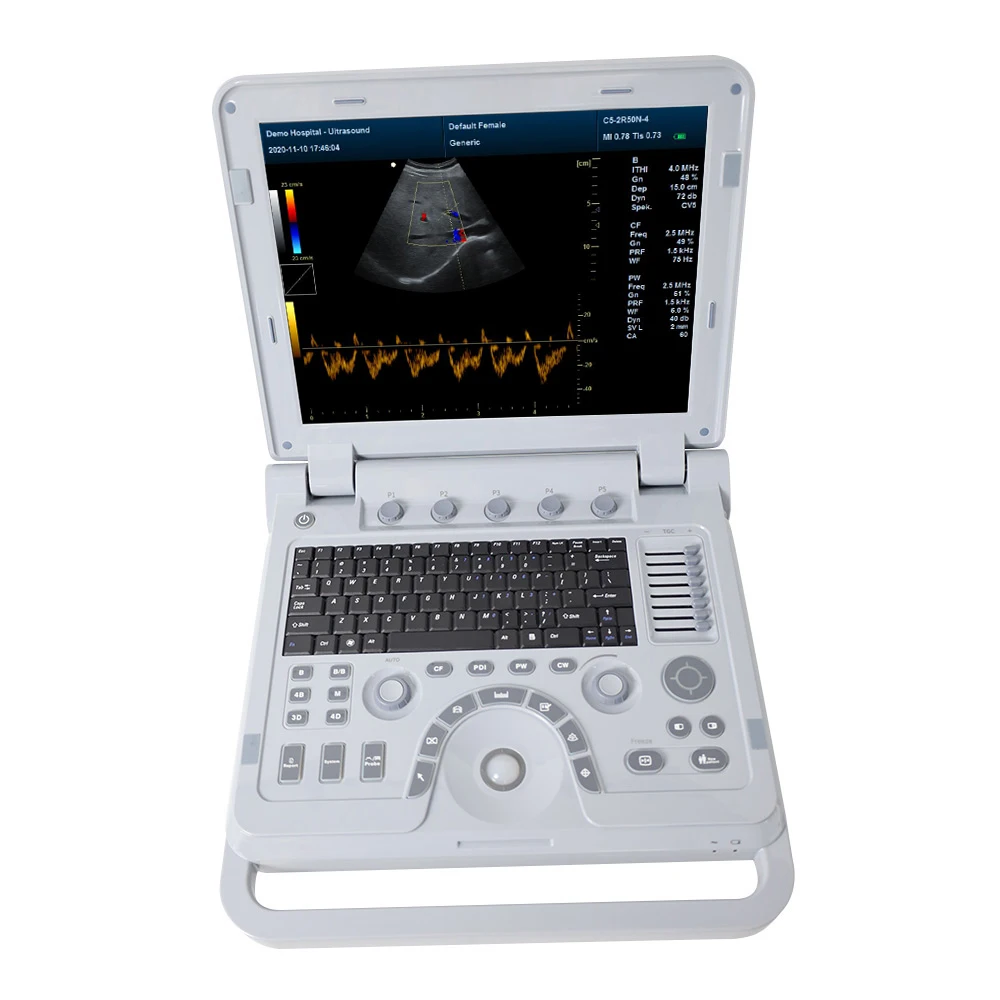 CONTEC CMS1700A ultrasonic diagnostic systems ultrasonography scanner color doppler machine