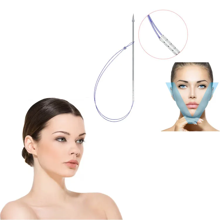 Heremefill  Collagen Face Skin Lifting Suture Needle Pdo Faden Cog Barbs Rose Contour Thread 4d With W Canula