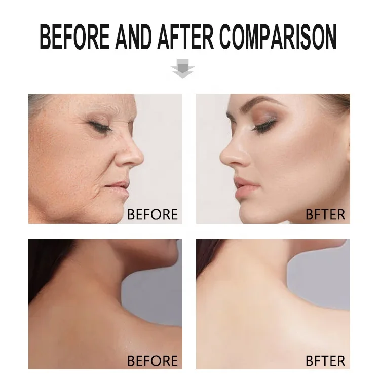 Alike 5 In 1 Double Glutathione Anti Pigment Spot Correcting Brightening Whitening Face Serum Skin Care For Brightening Oil