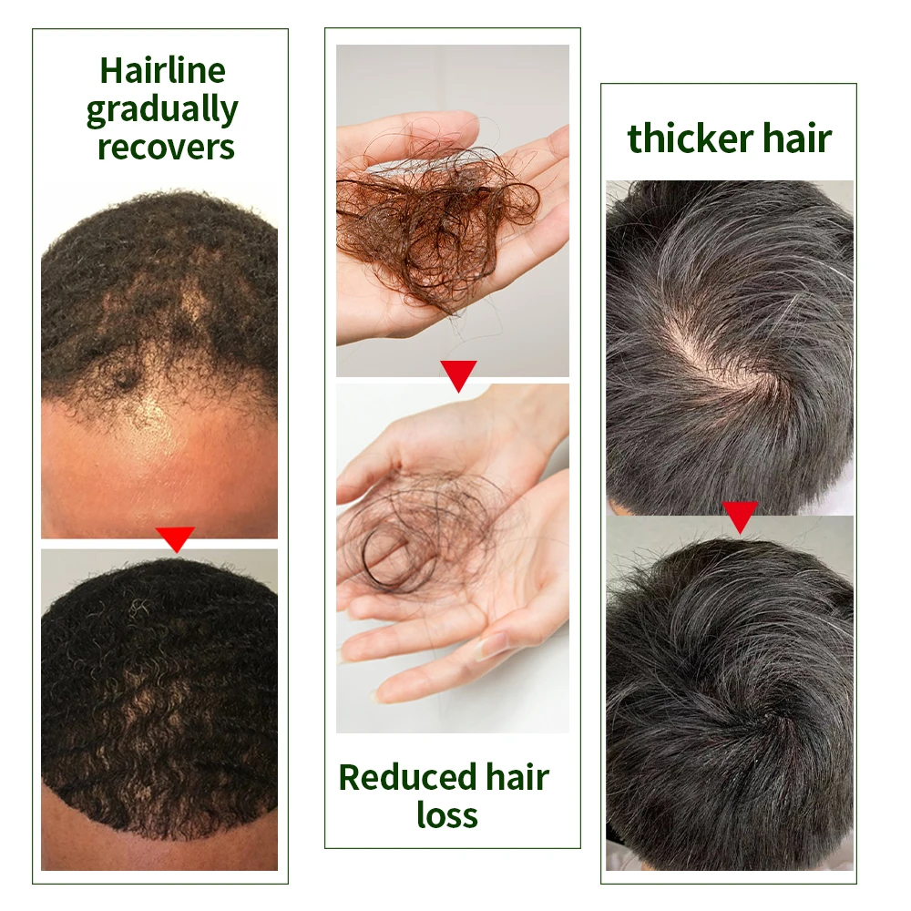 50 Moq Custom Private Label Best Black Women Natural Organic Herbal Ginger Hair Growth Oil Serum For Men Woman