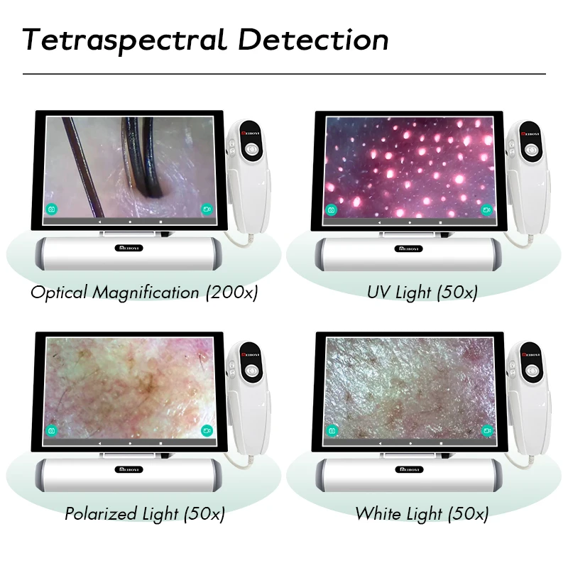 Meiboyi 2024 products smart HD touch screen hair detector analyzer scalp camera skin analyzer Head analysis machine Beautys