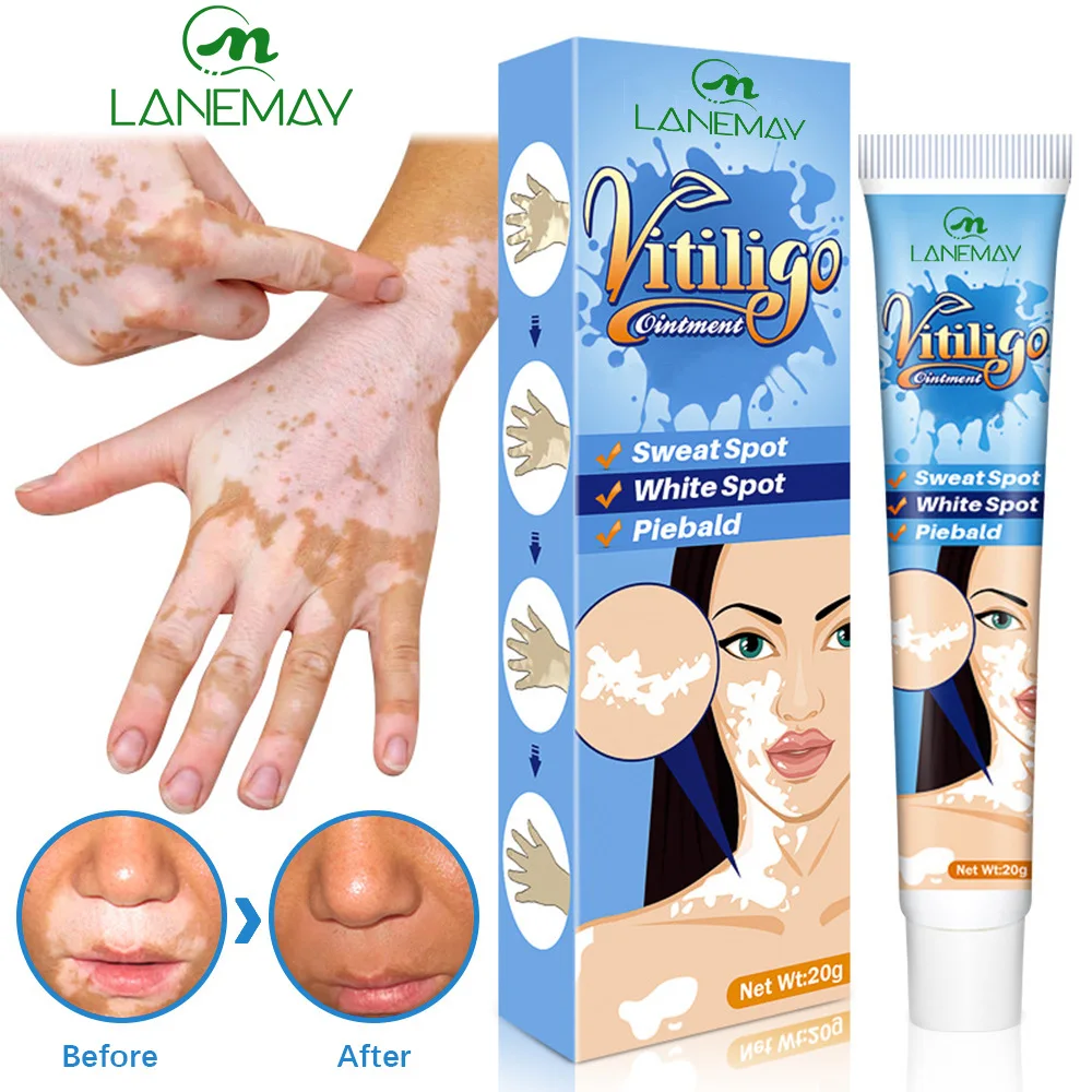 Herbal bacterial Cream Psoriasis Cream Anti-itch Relief Eczema Skin Rash Urticaria Desquamation Treatment