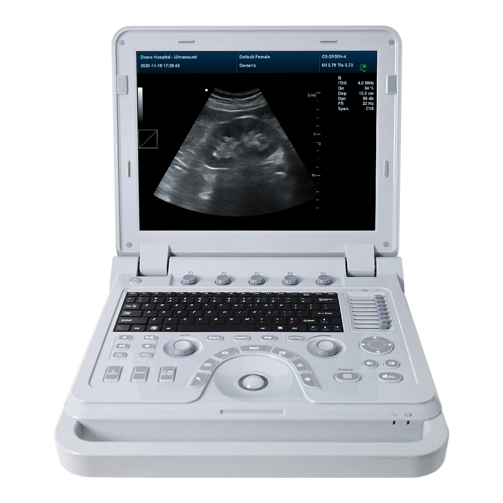 CONTEC CMS600P2PLUS ultrasound portable doppler ultrasound machine