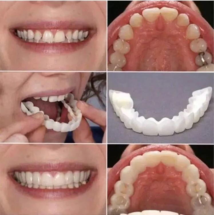 Upper And Lower Teeth Accessories Cover Silicone Artificial Teeth Cosmetic Dentistry Fits Most Comfortable Denture Car