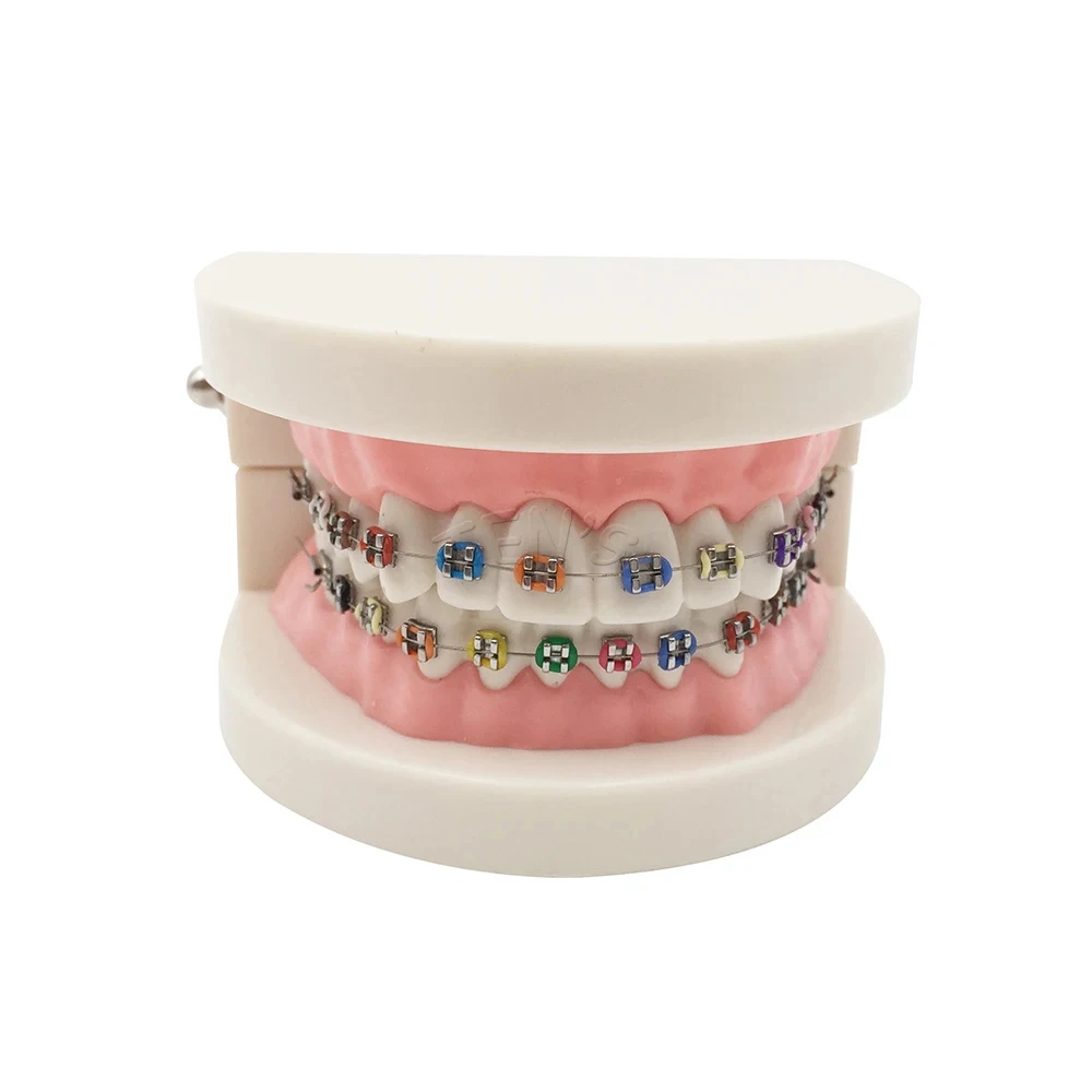 New Arrival Dental Equipments Brackets Products Odontologia Fashion Braces for Teeth