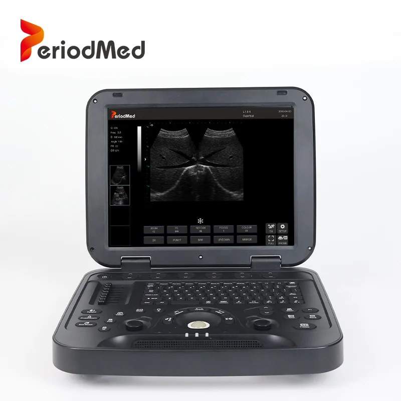 Periodmed professional convex and linear machine system with high quality ultrasound