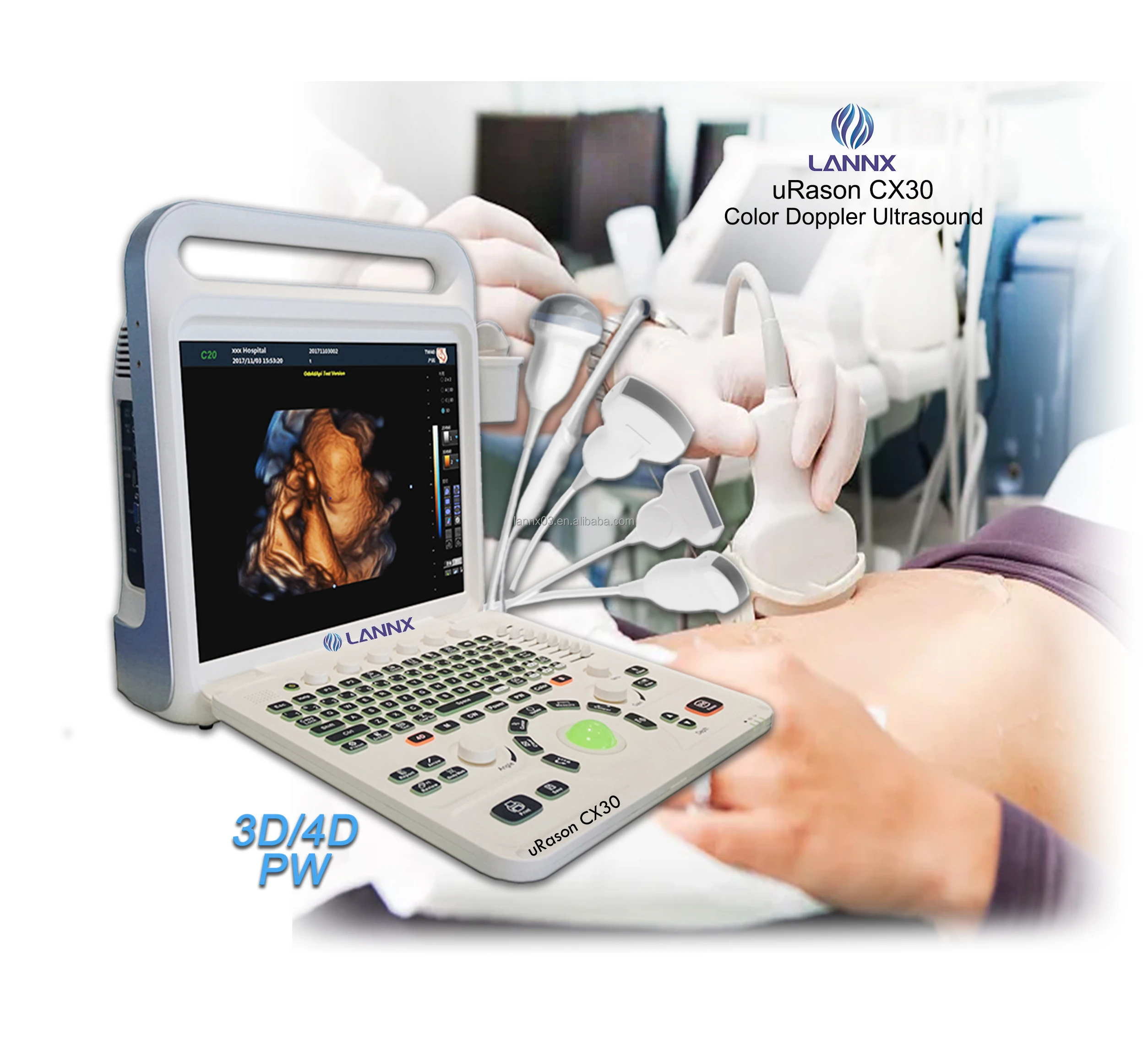 LANNX uRason CX30 New Arrival 3d/4d color doppler ultrasound ultrasonic Scanner Diagnostic System portable ultrasound machine