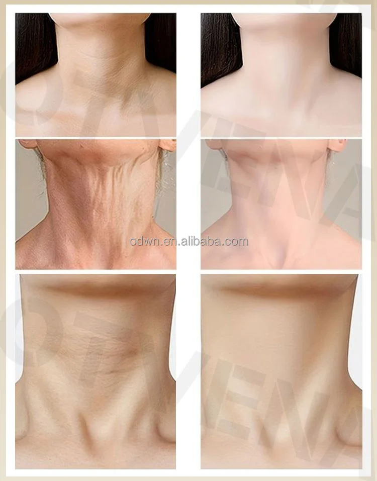 Copper Peptide Acne Treatment Korea Cosmetic Skin Care Powder Serum