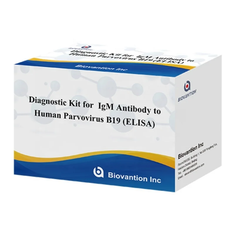 Elisa Diagnostic Kit for Human Parvovirus B19 IgM Antibody for hospital and lab