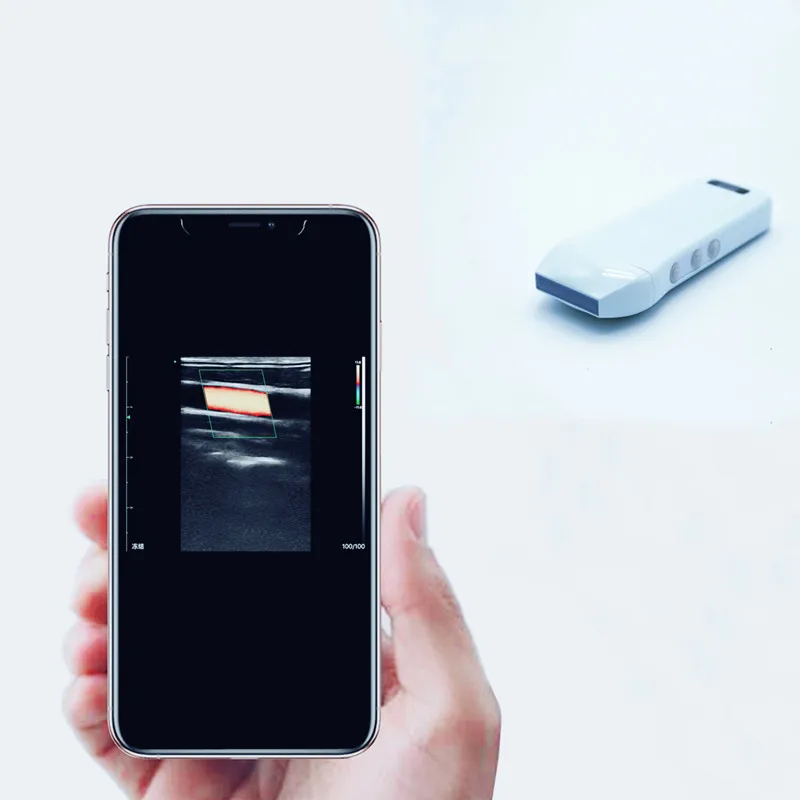 
Mini konted c10cx vascular color doppler ultrasound machine probe for pregnancy 