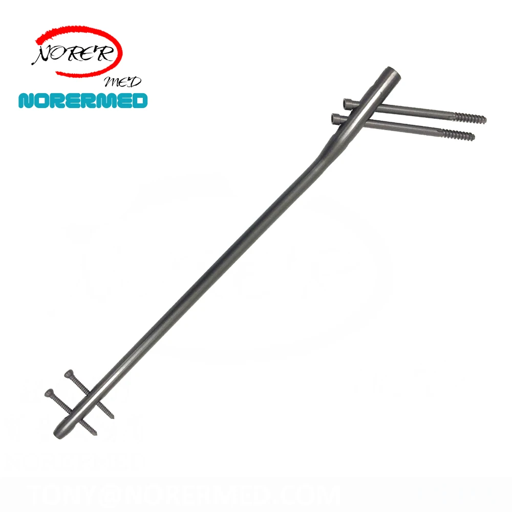 Chinese   Medical Orthopedic  Intramedullary Expert Femur Reconstruction Nailing Interlocking Nail System for Femoral neck fixat