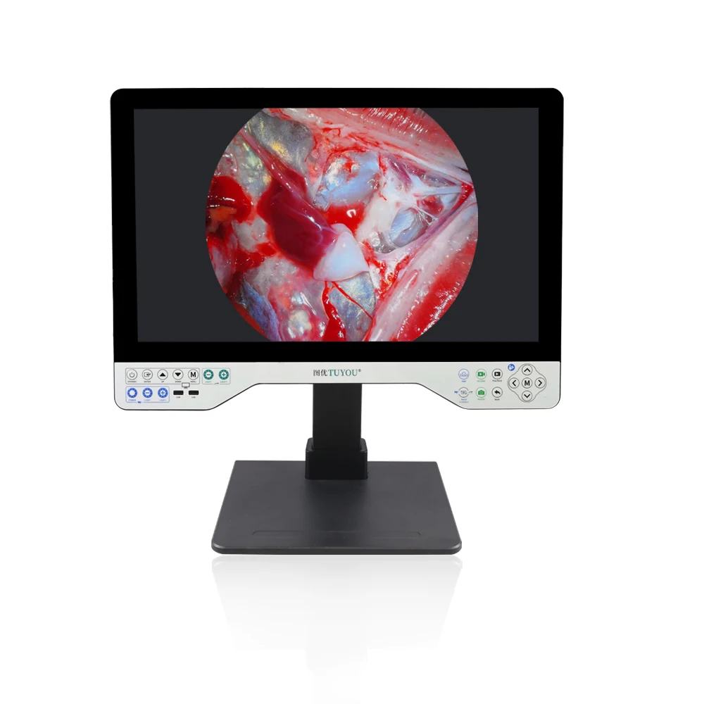 1080P 24 Inch medical endoscope camera combine flexible endoscope parts with rigid endoscope take photo&video and playback