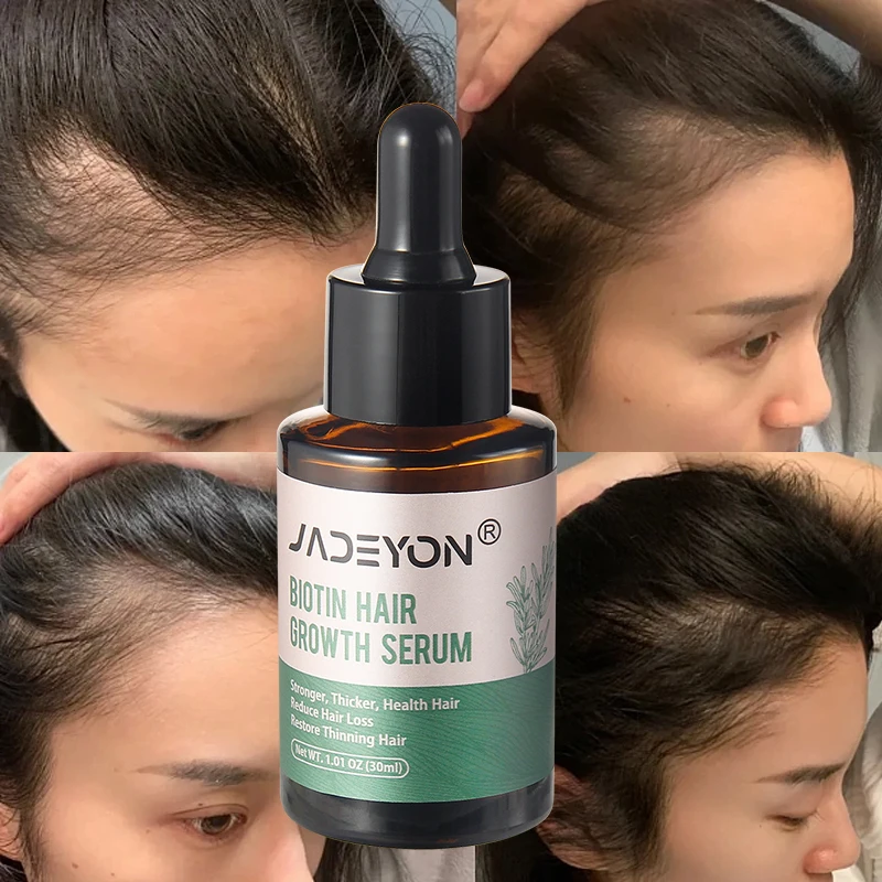 Private Label Hair Treatment Moisturizing Nourishing Pure Rosemary Oil For Hair Growth Loss Serum Natural Hair Growth Oil
